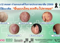สคร.12 สงขลา ร่วมรณรงค์วันราชประชาสมาสัย 2569 ภายใต้แนวคิด “ผื่นแบบไหน ควรรีบ ไปหาหมอ”