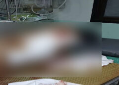 ชุมพร – หนุ่ม 19 ถูกมีดฟัน 4 แผล! ตำรวจละแมล่าตัวมือมีด “ช้าง”